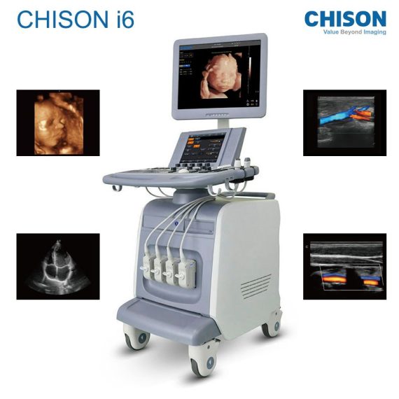 CHISON  I6